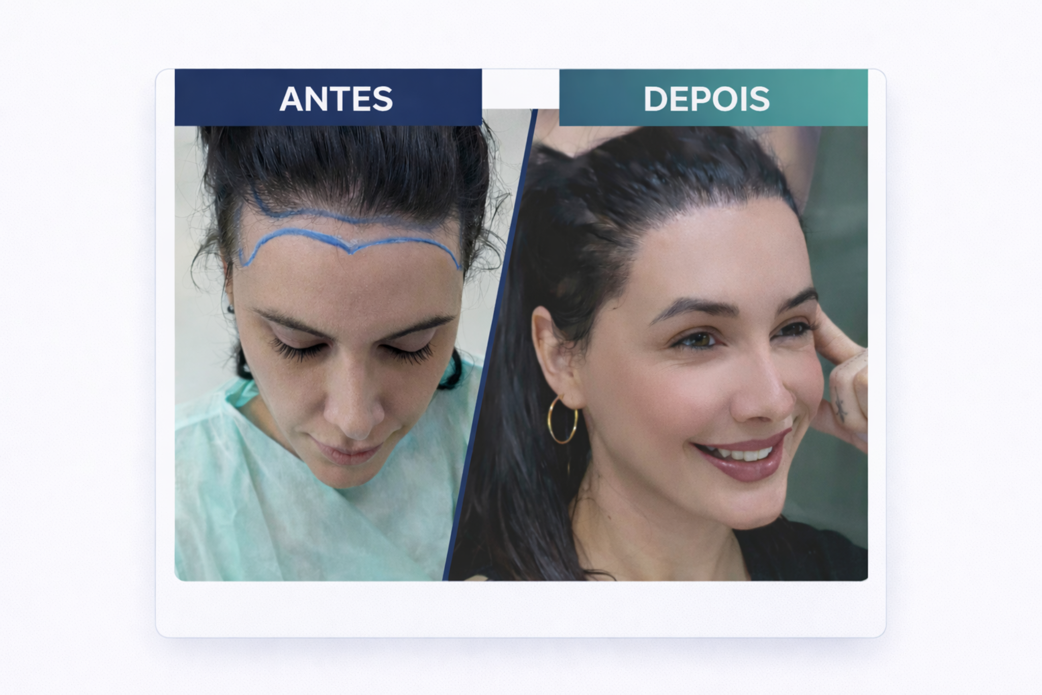 Antes e depois de Aline Silva