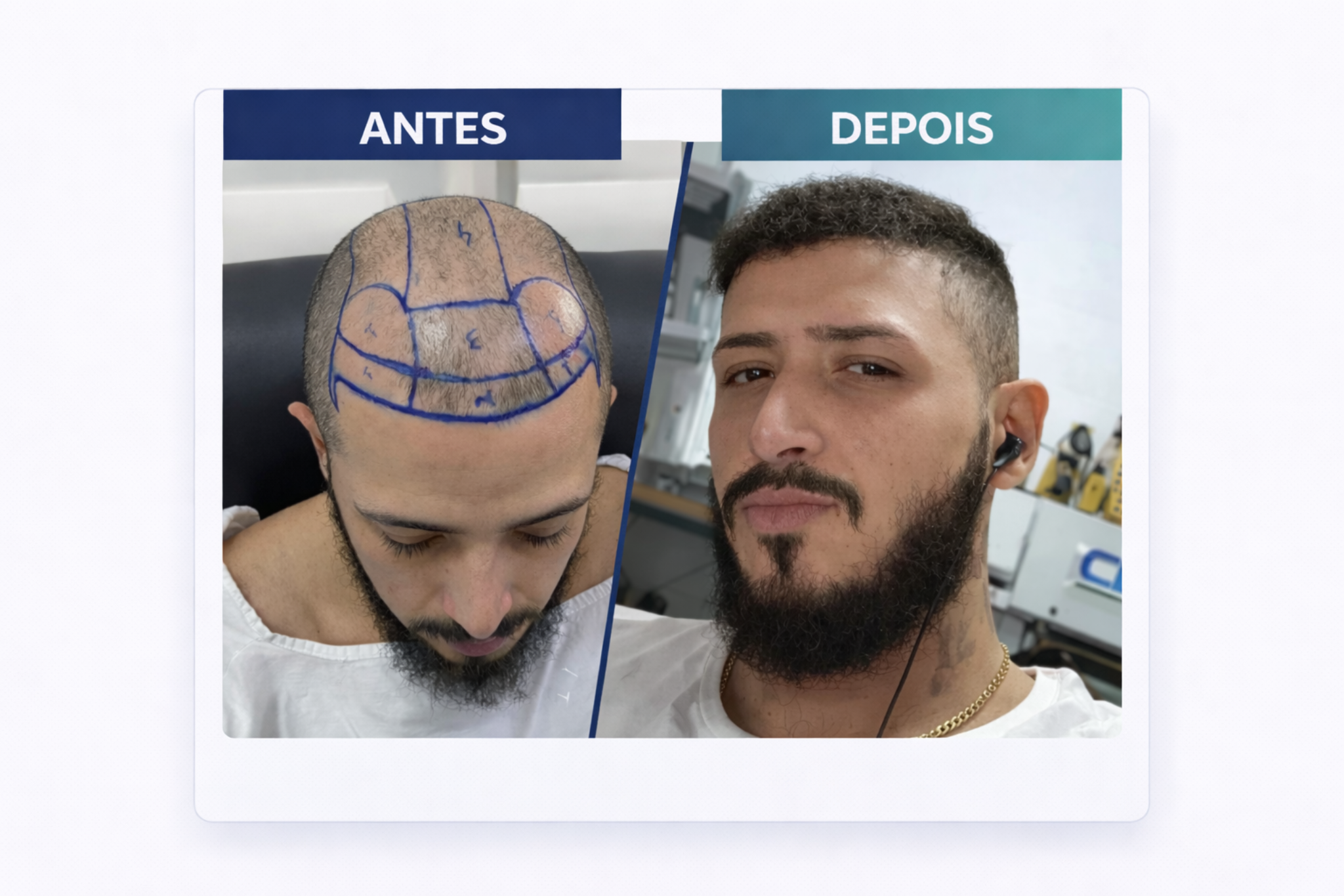 Antes e depois de Ricardinho