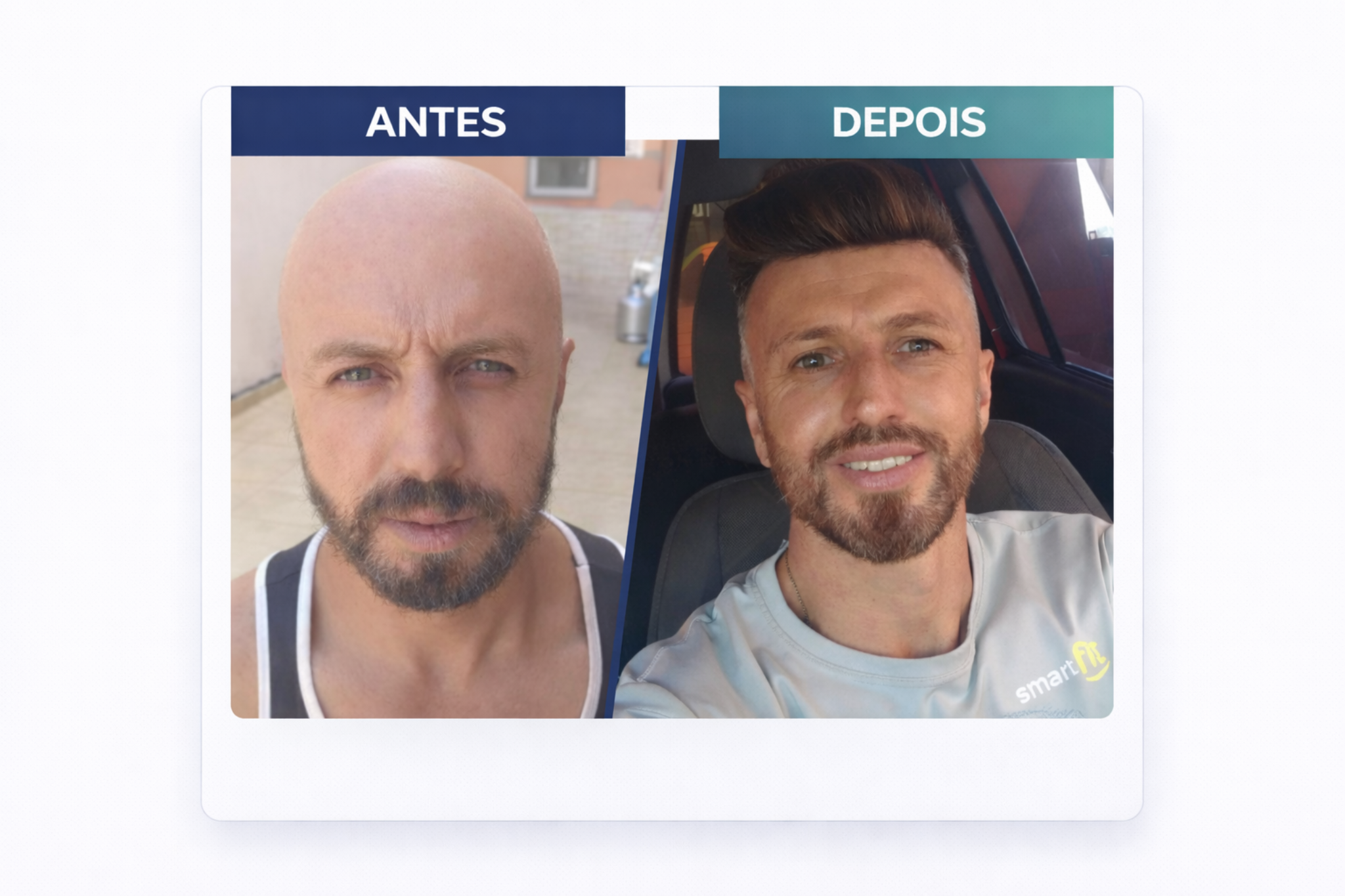 Antes e depois de Roberto Cunha